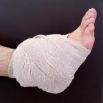 捻挫、突き指のアイシング