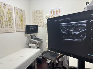 超音波画像検査 エコー