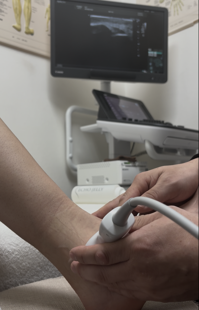 超音波画像検査（エコー）